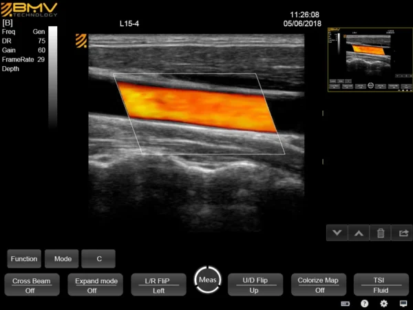 Echographe Doppler couleur tactile PT60 – Image 2